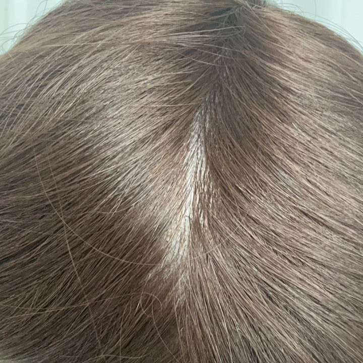 European Hair Injection Hair System | Skin 0.08mm | Size 8" x 10" - Hormel Wigs