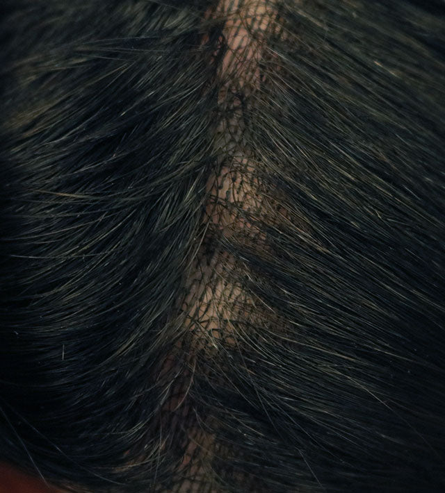 Skin (Vloop) - 8"*10" Thin Skin Men Hair System 0.10-0.12mm - Hormel Wigs